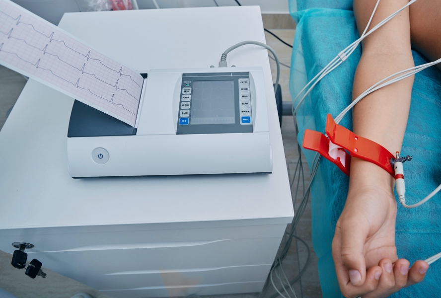 Când este obligatoriu un EKG preventiv? Ghid complet pentru protejarea inimii tale