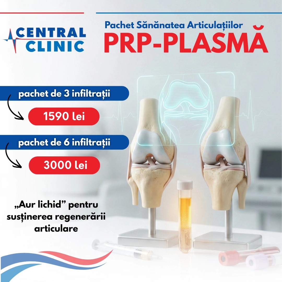 prp-plasma